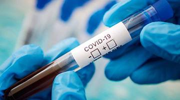 Картинка категории Коронавирус COVID-19